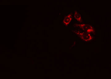 Thymidylate Kinase Antibody - Staining HeLa cells by IF/ICC. The samples were fixed with PFA and permeabilized in 0.1% Triton X-100, then blocked in 10% serum for 45 min at 25°C. The primary antibody was diluted at 1:200 and incubated with the sample for 1 hour at 37°C. An Alexa Fluor 594 conjugated goat anti-rabbit IgG (H+L) antibody, diluted at 1/600, was used as secondary antibody.