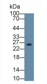 Thymidylate Kinase Antibody