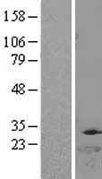 Thymidylate Kinase Protein - Western validation with an anti-DDK antibody * L: Control HEK293 lysate R: Over-expression lysate
