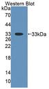 THYN1 / HSPC144 Antibody - Western blot of THYN1 / HSPC144 antibody.