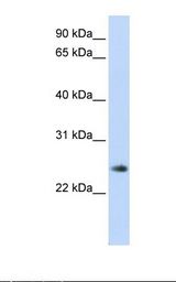 THYN1 / HSPC144 Antibody - Fetal muscle lysate. Antibody concentration: 1.0 ug/ml. Gel concentration: 12%.  This image was taken for the unconjugated form of this product. Other forms have not been tested.