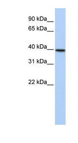 TIA-1 Antibody - TIA1 antibody Western blot of 721_B cell lysate. This image was taken for the unconjugated form of this product. Other forms have not been tested.