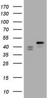 TIA-1 Antibody - HEK293T cells were transfected with the pCMV6-ENTRY control (Left lane) or pCMV6-ENTRY TIA1 (Right lane) cDNA for 48 hrs and lysed. Equivalent amounts of cell lysates (5 ug per lane) were separated by SDS-PAGE and immunoblotted with anti-TIA1.