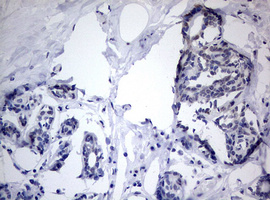 TIA-1 Antibody - IHC of paraffin-embedded Human breast tissue using anti-TIA1 mouse monoclonal antibody.