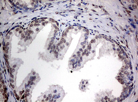 TIA-1 Antibody - IHC of paraffin-embedded Human prostate tissue using anti-TIA1 mouse monoclonal antibody.
