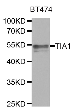 TIA-1 Antibody - Western blot analysis of extracts of BT474 cell line, using TIA1 antibody.