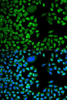 TIA-1 Antibody - Immunofluorescence analysis of HeLa cell using TIA1 antibody. Blue: DAPI for nuclear staining.