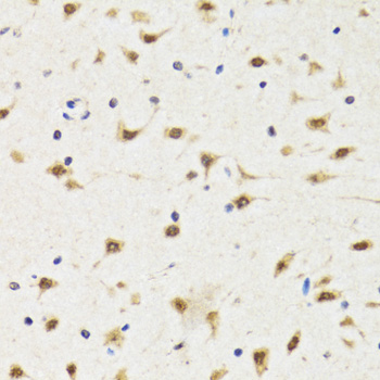 TIA-1 Antibody - Immunohistochemistry of paraffin-embedded rat brain tissue.