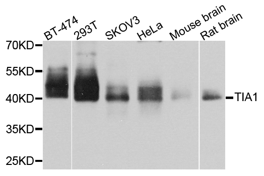 TIA-1 Antibody - Western blot analysis of extracts of various cell lines, using TIA1 antibody at 1:1000 dilution. The secondary antibody used was an HRP Goat Anti-Rabbit IgG (H+L) at 1:10000 dilution. Lysates were loaded 25ug per lane and 3% nonfat dry milk in TBST was used for blocking. An ECL Kit was used for detection and the exposure time was 5s.