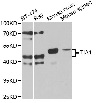 TIA-1 Antibody - Western blot analysis of extracts of various cell lines, using TIA1 antibody at 1:1000 dilution. The secondary antibody used was an HRP Goat Anti-Rabbit IgG (H+L) at 1:10000 dilution. Lysates were loaded 25ug per lane and 3% nonfat dry milk in TBST was used for blocking. An ECL Kit was used for detection and the exposure time was 15s.