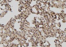 TIA-1 Antibody - 1:100 staining rat lung tissue by IHC-P. The sample was formaldehyde fixed and a heat mediated antigen retrieval step in citrate buffer was performed. The sample was then blocked and incubated with the antibody for 1.5 hours at 22°C. An HRP conjugated goat anti-rabbit antibody was used as the secondary.