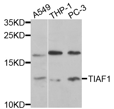 TIAF1 Antibody - Western blot analysis of extracts of various cells.