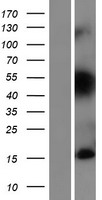 TIAF1 Protein - Western validation with an anti-DDK antibody * L: Control HEK293 lysate R: Over-expression lysate