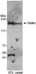 TIAM1 Antibody - Detection of Human and Mouse TIAM1 by Western Blot. Samples: Whole cell lysate from NIH-3T3 (50 ug) and Jurkat (25 ug) cells. Antibody: Affinity purified rabbit anti-TIAM1 antibody used at 1 ug/ml. Detection: Chemiluminescence with an exposure time of 2 minutes.