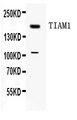 TIAM1 Antibody - Western blot - Anti-TIAM1 Picoband Antibody