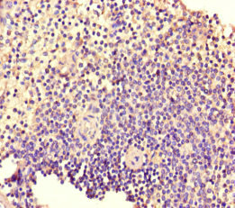 TIAM1 Antibody - Immunohistochemistry of paraffin-embedded human spleen tissue at dilution of 1:100