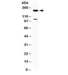 TIAM1 Antibody - Western blot testing of human MCF7 cell lysate with TIAM1 antibody at 0.5ug/ml. Predicted/observed molecular weight ~178 kDa.
