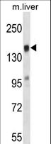 TIAM2 Antibody - TIAM2 Antibody western blot of mouse liver tissue lysates (35 ug/lane). The TIAM2 antibody detected the TIAM2 protein (arrow).