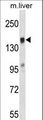 TIAM2 Antibody - TIAM2 Antibody western blot of mouse liver tissue lysates (35 ug/lane). The TIAM2 antibody detected the TIAM2 protein (arrow).