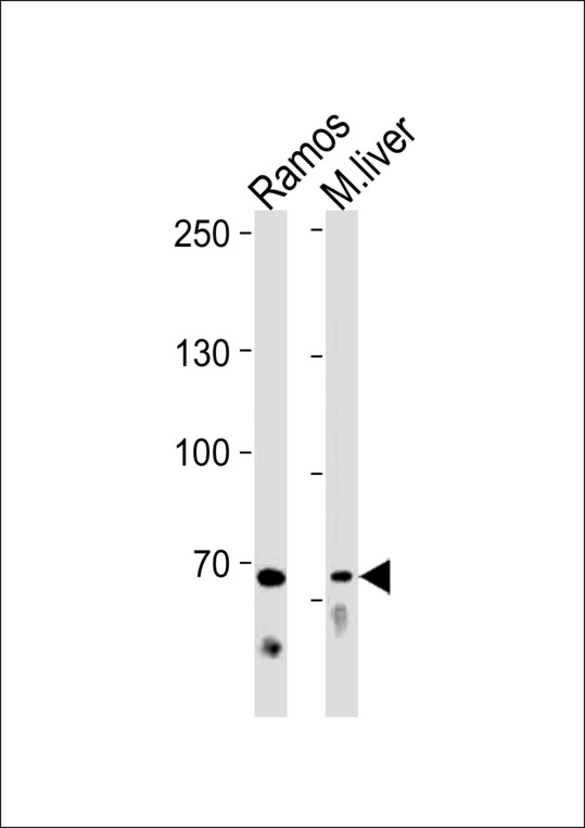 TICAM1 / TRIF Antibody - TICAM1 Antibody western blot of Ramos cell line and mouse liver tissue lysates (35 ug/lane). The TICAM1 antibody detected the TICAM1 protein (arrow).