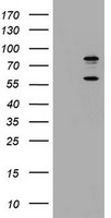TICAM1 / TRIF Antibody - HEK293T cells were transfected with the pCMV6-ENTRY control (Left lane) or pCMV6-ENTRY TICAM1 (Right lane) cDNA for 48 hrs and lysed. Equivalent amounts of cell lysates (5 ug per lane) were separated by SDS-PAGE and immunoblotted with anti-TICAM1.
