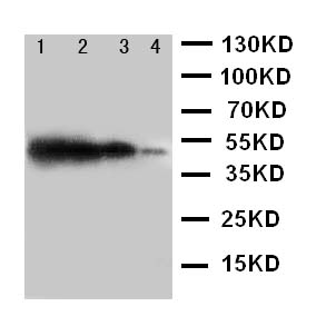 TICAM1 / TRIF Antibody - WB of TICAM1 / TRIF antibody. Recombinant Protein Detection Source:. E.coli derived -recombinant Human TICAM1, 44.7KD. (162aa tag+ Q468-E712). Lane 1: Recombinant Human TICAM1 Protein 10ng. Lane 2: Recombinant Human TICAM1 Protein 5ng. Lane 3: Recombinant Human TICAM1 Protein 2.5ng. Lane 4: Recombinant Human TICAM1 Protein 1.25ng.
