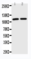 TICAM1 / TRIF Antibody - WB of TICAM1 / TRIF antibody. Lane 1: JURKAT Cell Lysate. Lane 2: HL-60 Cell Lysate.