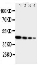 TICAM1 / TRIF Antibody - Anti-TRIF antibody, Western blottingRecombinant Protein Detection Source: E. coli derived -recombinant Human TICAM1, 44. 7KD (162aa tag+ Q468-E712)Lane 1: Recombinant Human TICAM1 Protein 10ng Lane 2: Recombinant Human TICAM1 Protein 5ng Lane 3: Recombinant Human TICAM1 Protein 2. 5ng Lane 4: Recombinant Human TICAM1 Protein 1. 25ng
