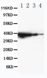 TICAM1 / TRIF Antibody - WB of TICAM1 / TRIF antibody. Recombinant Protein Detection Source:. E.coli derived -recombinant Mouse TICAM1,37.5KD. (162aa tag+ L551-E732). Lane 1: Recombinant Mouse TICAM1 Protein 10ng. Lane 2: Recombinant Mouse TICAM1 Protein 5ng. Lane 3: Recombinant Mouse TICAM1 Protein 2.5ng. Lane 4: Recombinant Mouse TICAM1 Protein 1.25ng.