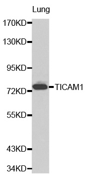 TICAM1 / TRIF Antibody - Western blot analysis of lung cell lysate.