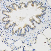 TICAM1 / TRIF Antibody - Immunohistochemistry of paraffin-embedded rat lung tissue.