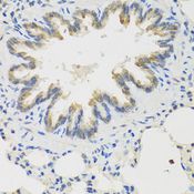 TICAM1 / TRIF Antibody - Immunohistochemistry of paraffin-embedded rat lung using TICAM1 antibody at dilution of 1:100 (40x lens).