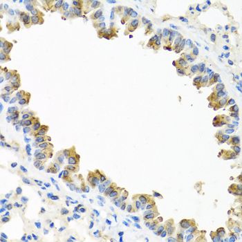 TICAM1 / TRIF Antibody - Immunohistochemistry of paraffin-embedded mouse lung using TICAM1 antibody at dilution of 1:100 (40x lens).