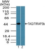 TICAM2 / TRAM Antibody - Western blot of TAG/TIRAP3b in K562 cell lysate in the 1) absence and 2) presence of immunizing peptide using Polyclonal Antibody to TAG/TIRAP3b at 3 ug/ml. Goat anti-rabbit Ig HRP secondary antibody, and PicoTect ECL substrate solution, were used for this test.