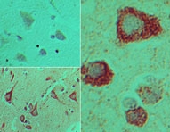 TICAM2 / TRAM Antibody - IHC of TAG/TIRAP3b in formalin-fixed, paraffin-embedded human brain tissue using an isotype control (top left) and Polyclonal Antibody to TAG/TIRAP3b (bottom left, right) at 5 ug/ml.