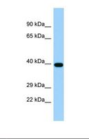 TICAM2 / TRAM Antibody - Western blot of Human RPMI-8226. TIRAP3 antibody dilution 1.0 ug/ml.  This image was taken for the unconjugated form of this product. Other forms have not been tested.