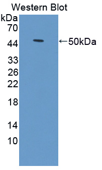 TICAM2 / TRAM Antibody - Western blot of TICAM2 / TRAM antibody.