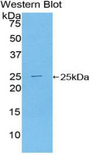 TICAM2 / TRAM Antibody - Western blot of recombinant TICAM2 / TRAM.  This image was taken for the unconjugated form of this product. Other forms have not been tested.