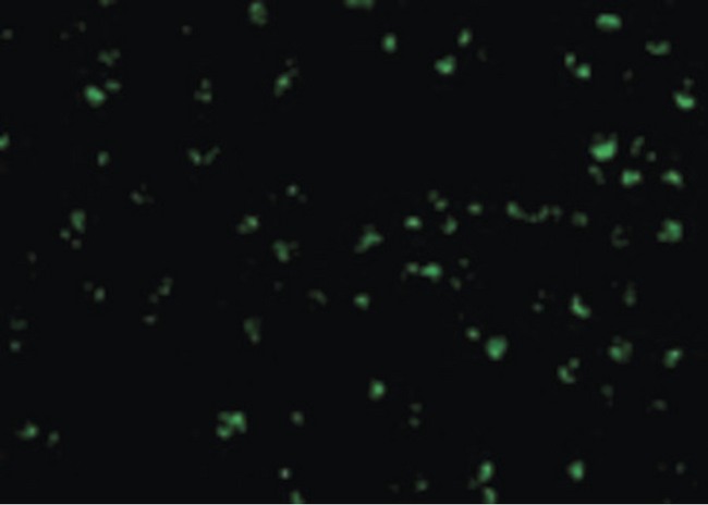 TICAM2 / TRAM Antibody - Immunofluorescence of TIRP in Raji cells with TIRP antibody at 10 ug/ml.