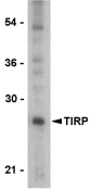 TICAM2 / TRAM Antibody - Western blot of TIRP in PC-3 cell lysate with TIRP antibody at 1 ug/ml.