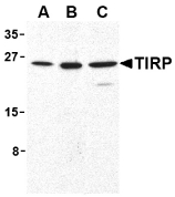 TICAM2 / TRAM Antibody - Western blot of TIRP in human (A), mouse (B), and rat (C) kidney cell lysates with TIRP antibody at 1 ug/ml.