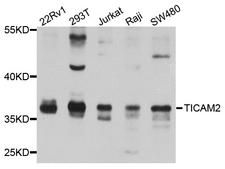 TICAM2 / TRAM Antibody - Western blot analysis of extract of various cells.