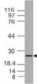 TICAM2 / TRAM Antibody - Fig-1: Western blot analysis of TRAM. Anti-TRAM antibody was used at 4 µg/ml on SKBR3 lysate.