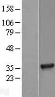 TICAM2 / TRAM Protein - Western validation with an anti-DDK antibody * L: Control HEK293 lysate R: Over-expression lysate