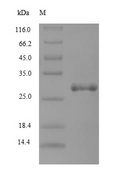 Tick anticoagulant peptide Protein - (Tris-Glycine gel) Discontinuous SDS-PAGE (reduced) with 5% enrichment gel and 15% separation gel.