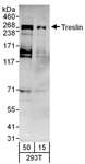 TICRR Antibody - Detection of Human Treslin by Western Blot. Samples: Whole cell lysate (15 and 50 ug) from 293T cells. Antibodies: Affinity purified rabbit anti-Treslin antibody used for WB at 0.4 ug/ml. Detection: Chemiluminescence with an exposure time of 3 minutes.