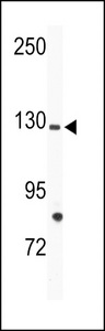TIE Antibody - Western blot of anti-TIE Antibody in mouse bladder tissue lysates (35 ug/lane). TIE(arrow) was detected using the purified antibody.