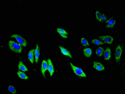 TIE1 / TIE Antibody - Immunofluorescent analysis of A549 cells at a dilution of 1:100 and Alexa Fluor 488-congugated AffiniPure Goat Anti-Rabbit IgG(H+L)