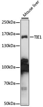 TIE1 / TIE Antibody - Western blot analysis of extracts of mouse liver, using TIE1 antibody at 1:1000 dilution. The secondary antibody used was an HRP Goat Anti-Rabbit IgG (H+L) at 1:10000 dilution. Lysates were loaded 25ug per lane and 3% nonfat dry milk in TBST was used for blocking. An ECL Kit was used for detection and the exposure time was 10s.