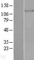TIE1 / TIE Protein - Western validation with an anti-DDK antibody * L: Control HEK293 lysate R: Over-expression lysate